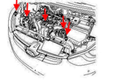 схема крепления решетки радиатора Hyundai Elantra (2010-2015)